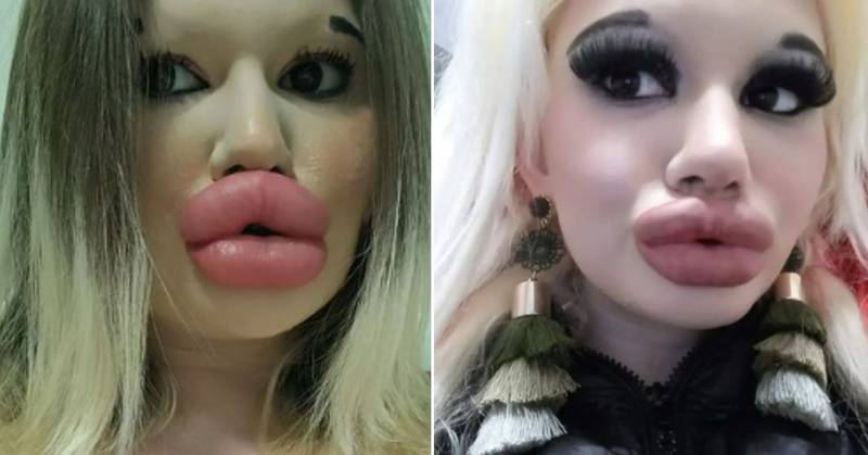 Andrea Ivanova, oriunda de Bulgaria quiere los labios y los pómulos más grandes del mundo