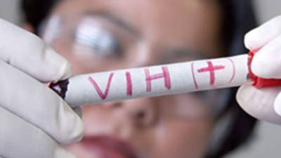 La primera auto prueba de saliva para detectar HIV ya está en el mercado