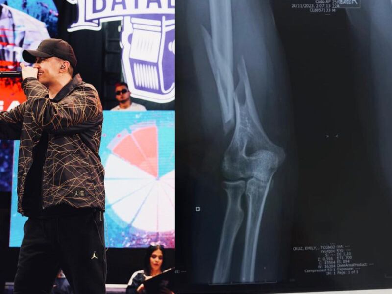 “Me causó tres fracturas”: Expareja del rapero Carpediem lo denunció por violencia doméstica