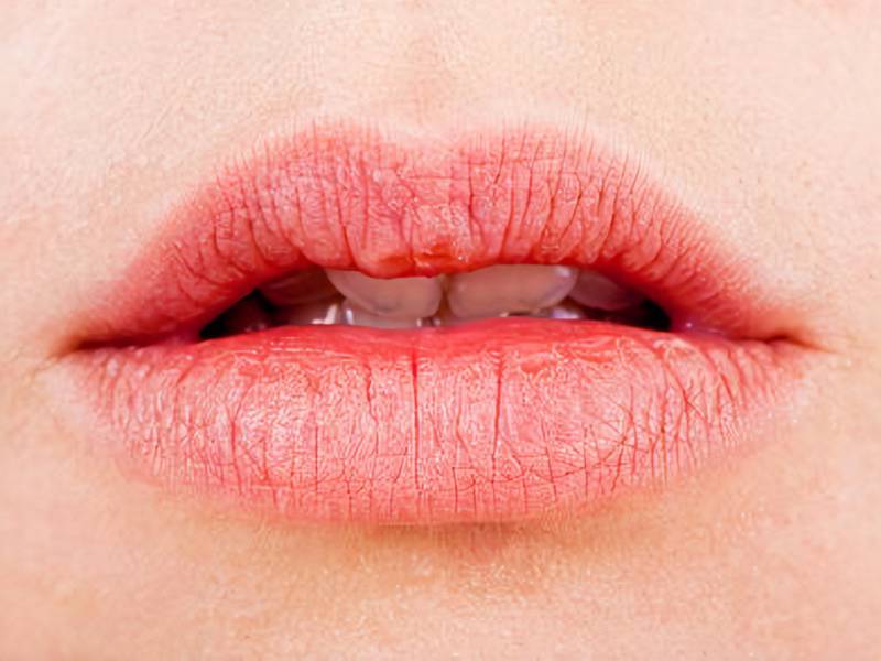 Invierno en Sudamérica: Tips para mantener los labios protegidos