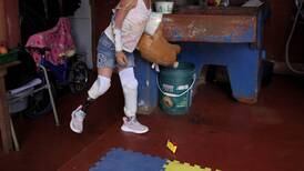 Niño rifa un pollo: Busca comprar prótesis para su pierna y así poder ir al colegio
