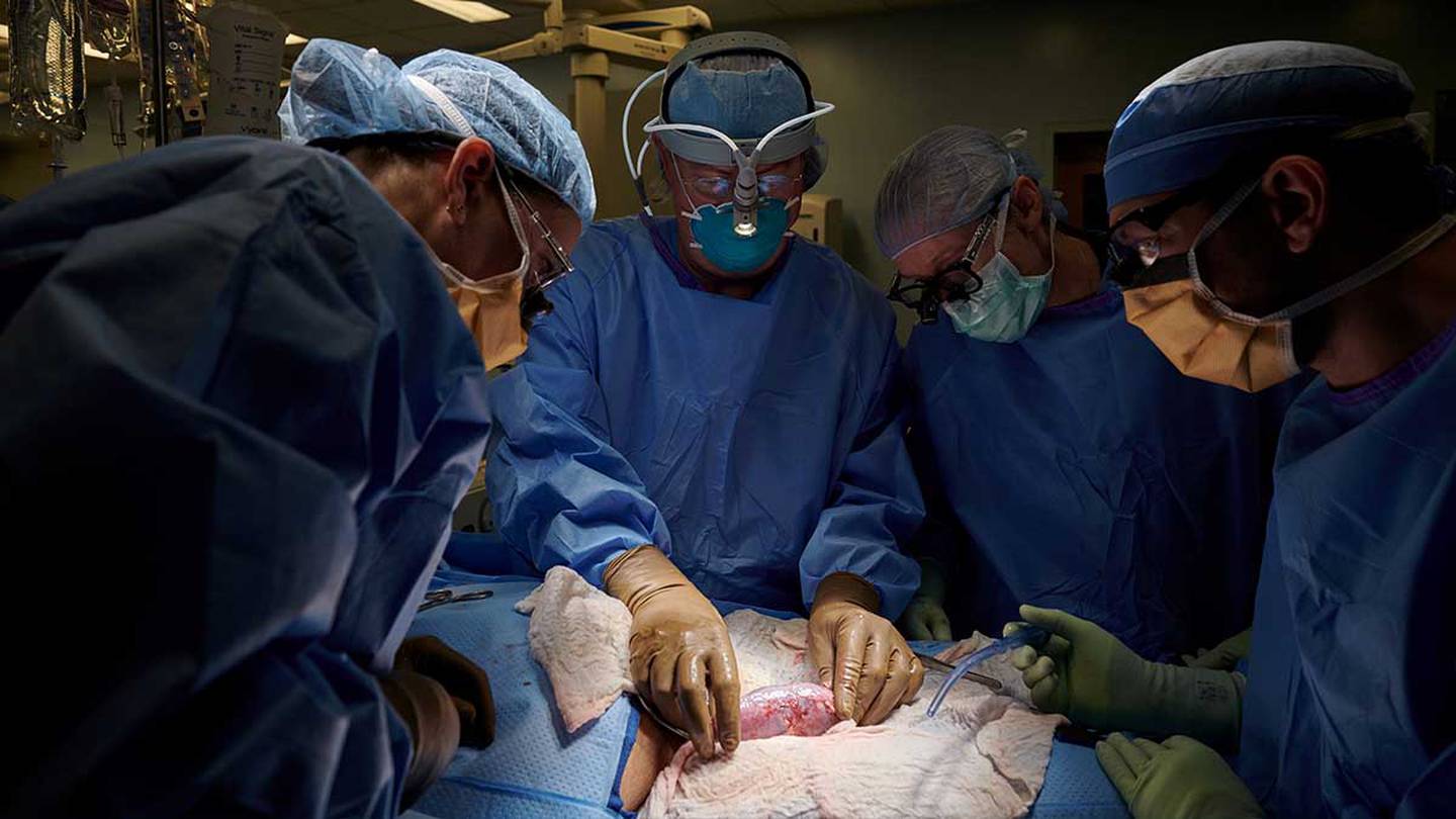 Trasplante de riñón de un cerdo a un humano
