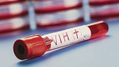 Descubren una nueva variante del VIH más dañina y transmisible que las ya conocidas