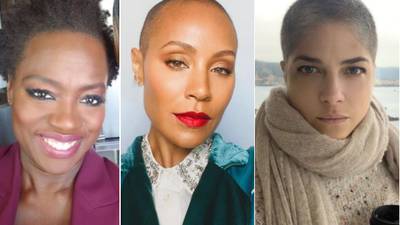 Estas famosas demuestran que no debes avergonzarte si estás luchando contra la pérdida de cabello