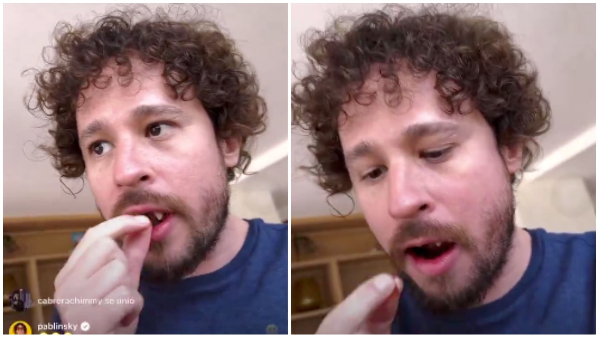 “Ahora si quedó como chimuelo”: A Luisito Comunica se le cayeron los dientes en medio de un en vivo, ¿qué le pasó? (Redes sociales)