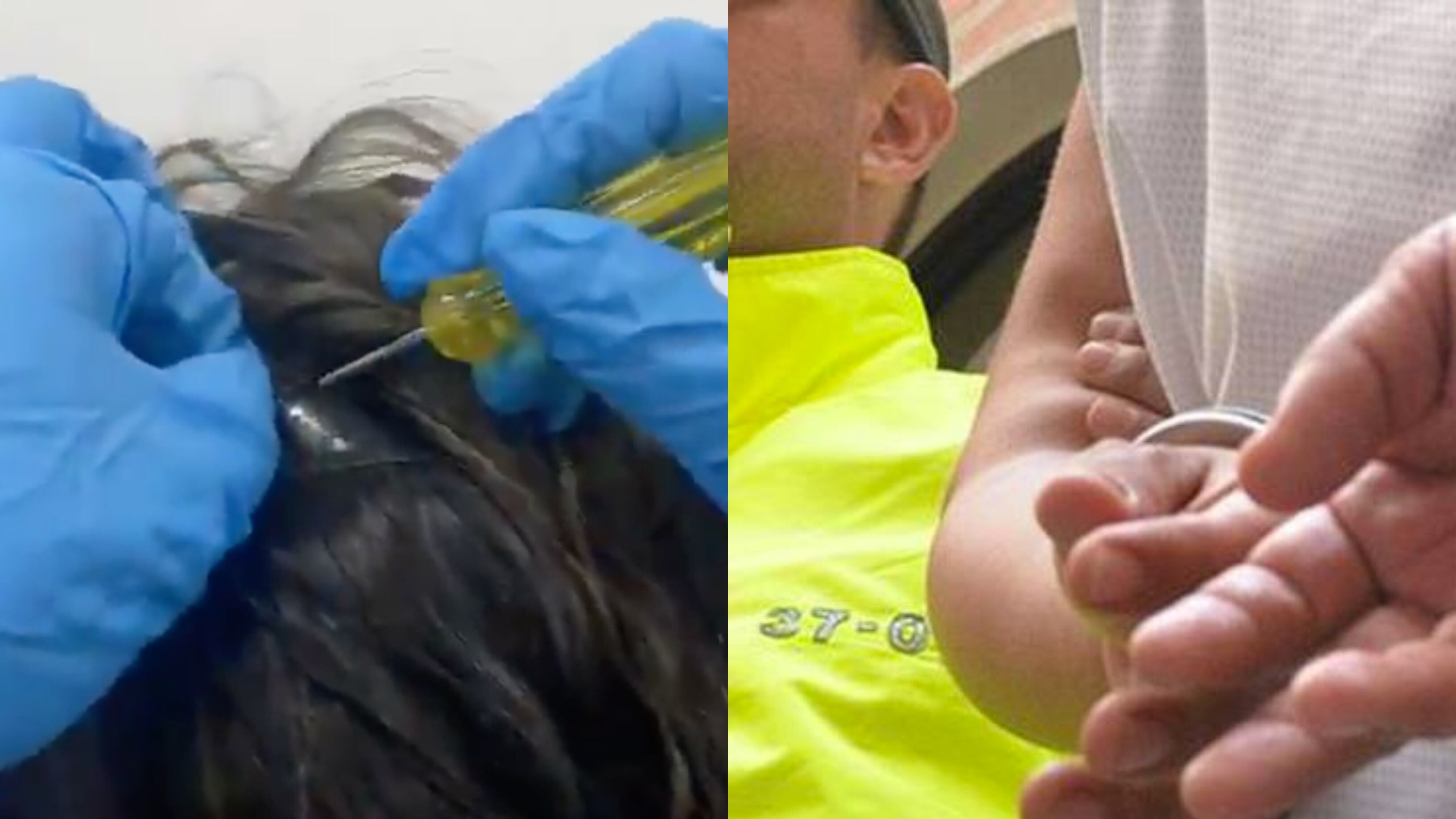 Nacopelucas en Colombia