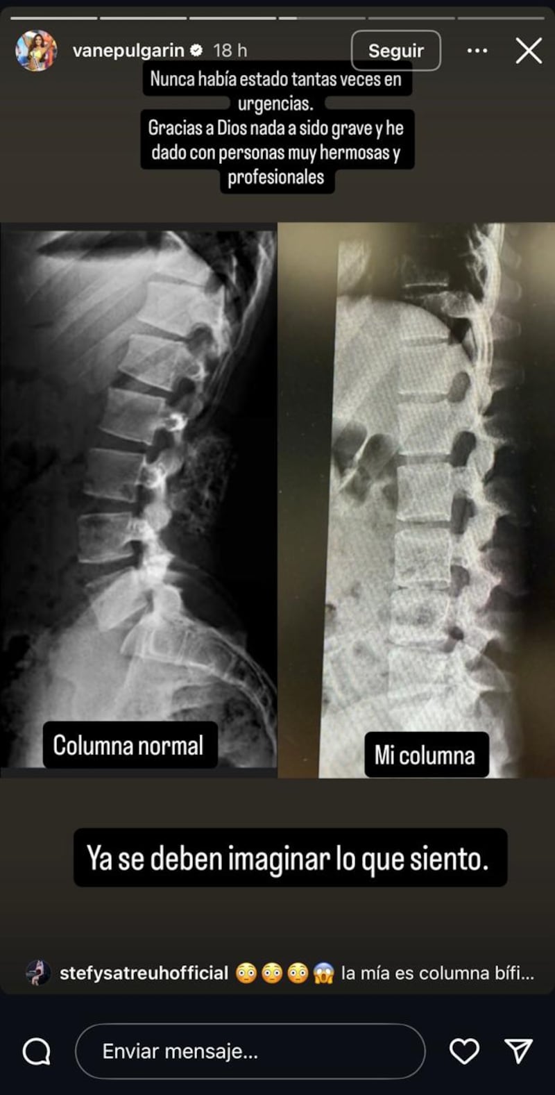 Vanessa Pulgarín MIss Universe.