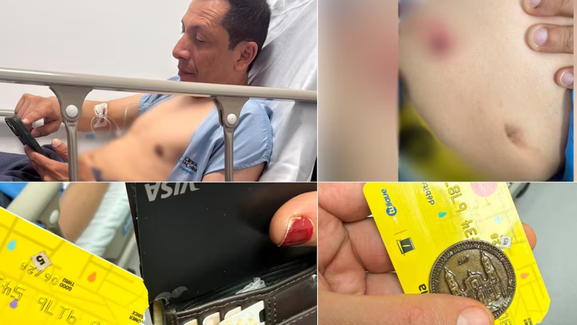 Funcionario del MinInterior herido.