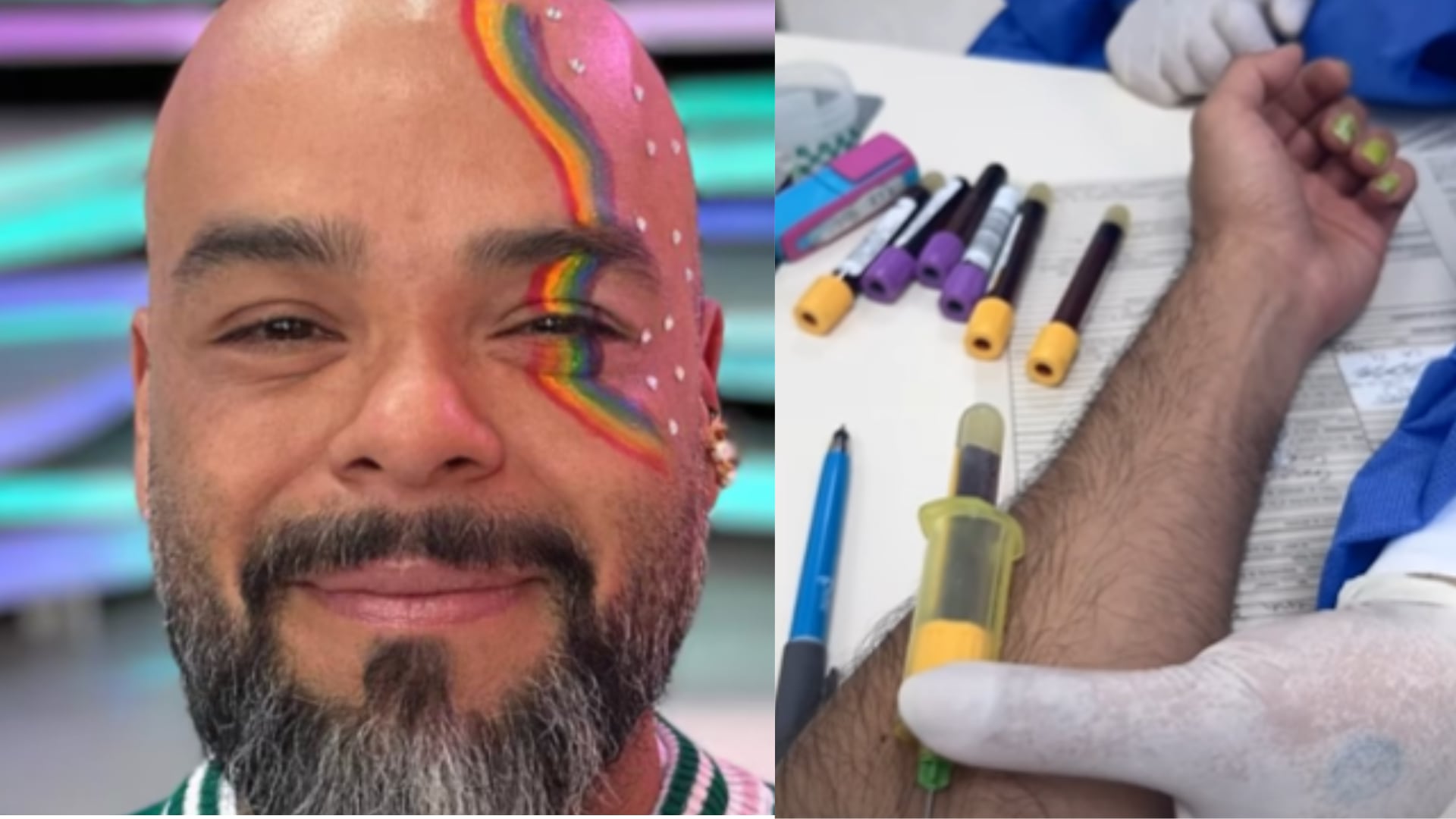 Carlos Vargas preocupó a sus seguidores con los problemas de salud que están afectando en su trabajo