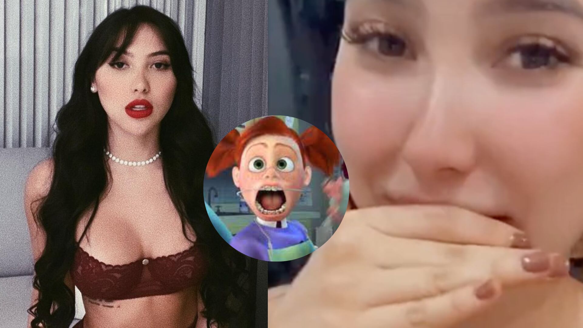 Aida Victoria Merlano se quita su diseño de sonrisa