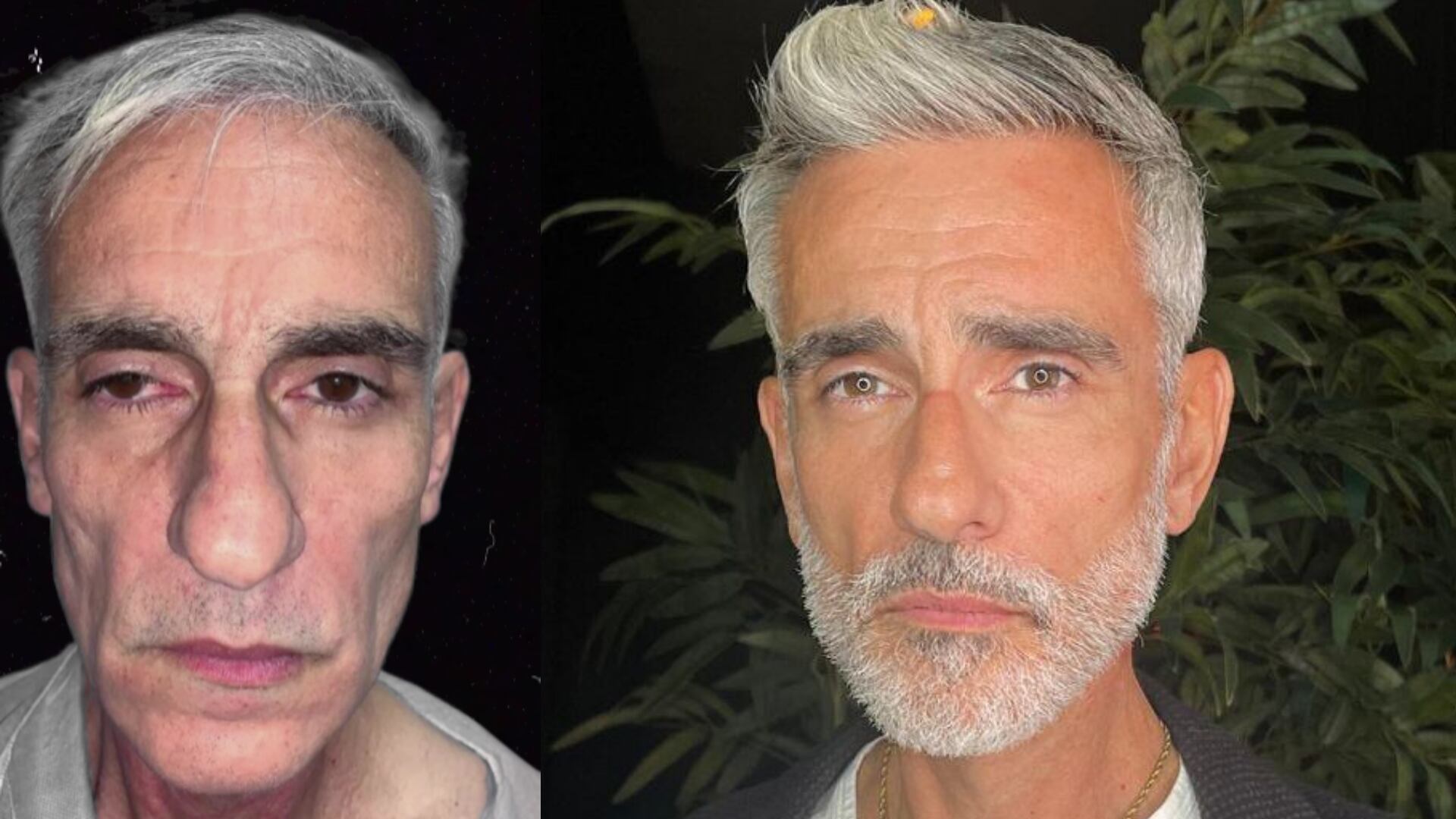 Miguel Varoni pidió no satanizar las cirugías para bajar de peso