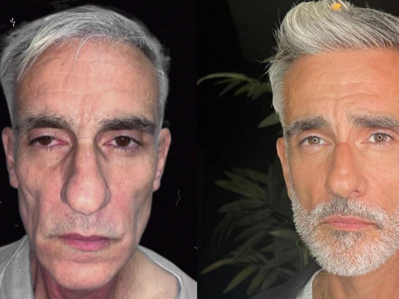 Miguel Varoni volvió a sus redes sociales con “20 años menos” gracias a este ‘retoquito’ estético