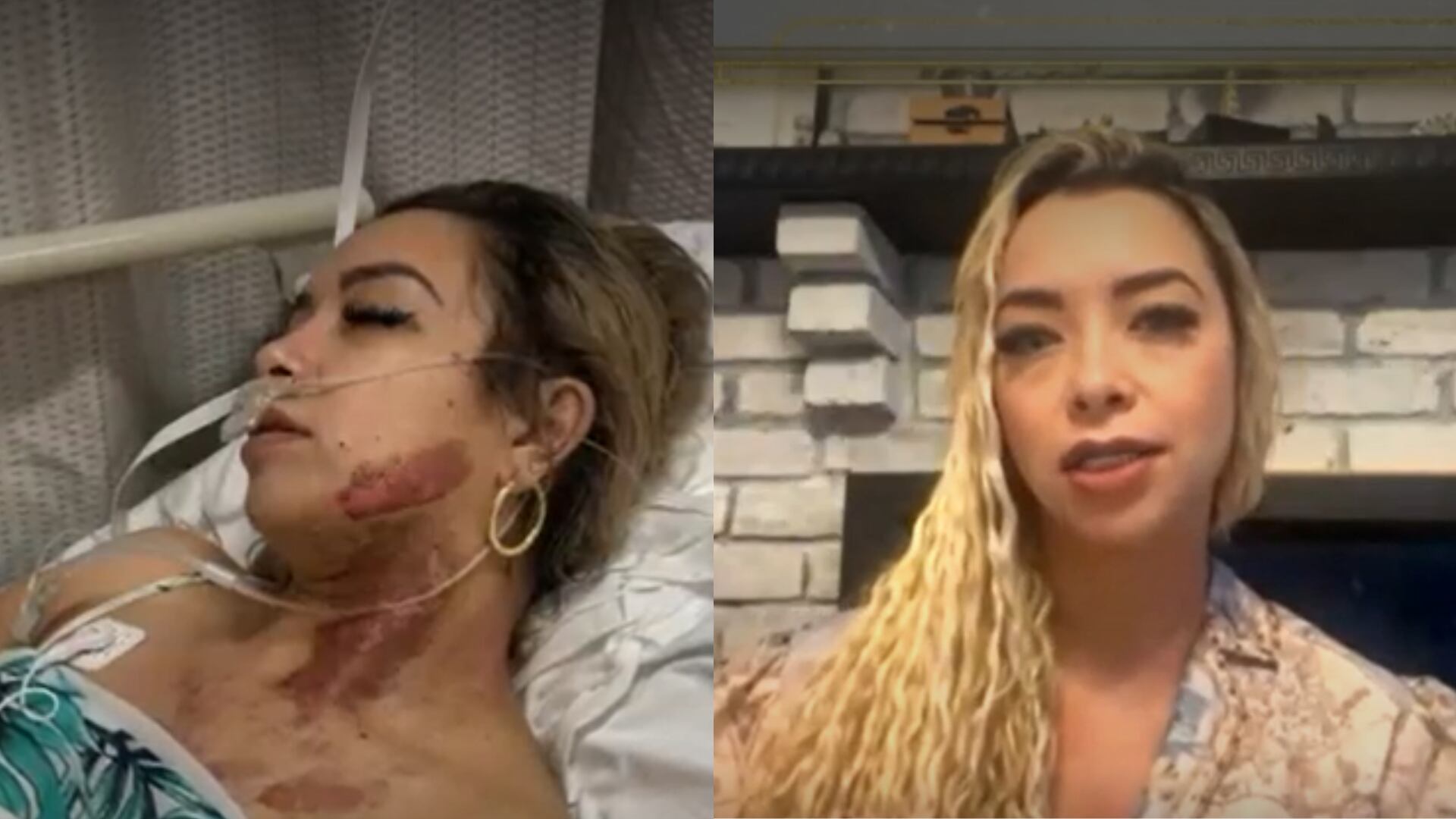 Hija de Pastor López revela que fue víctima de un ataque con ácido