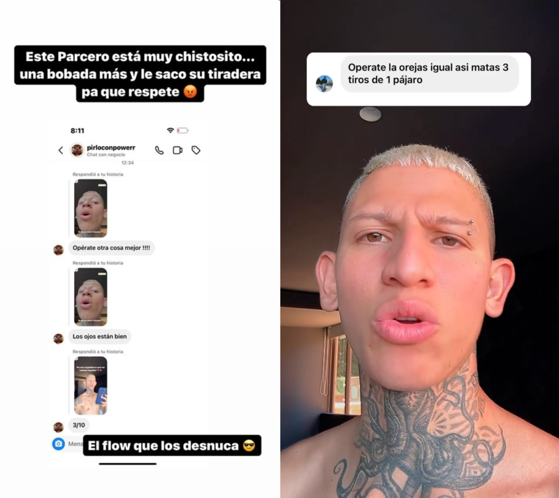 La Liendra se molestó porque criticaron sus orejas en más de una ocasión