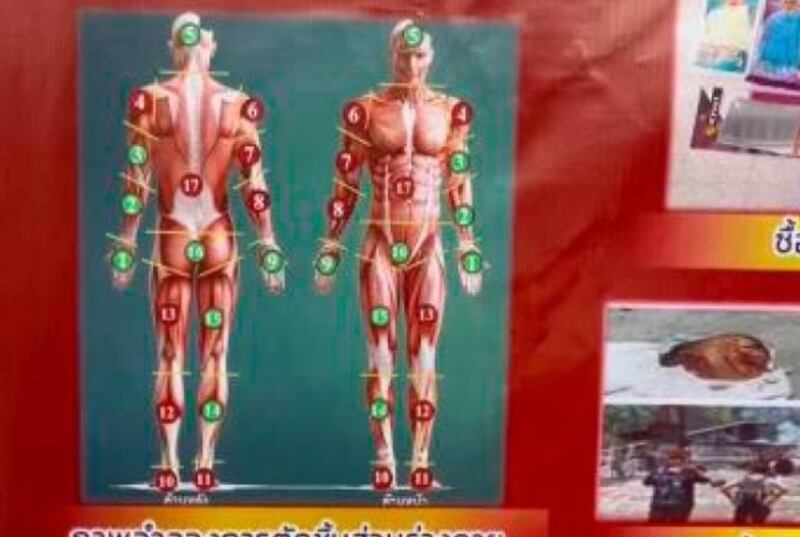 La evidencia del crimen del cirujano Edwin Arrieta presentada en la Fiscalía de Tailandia.