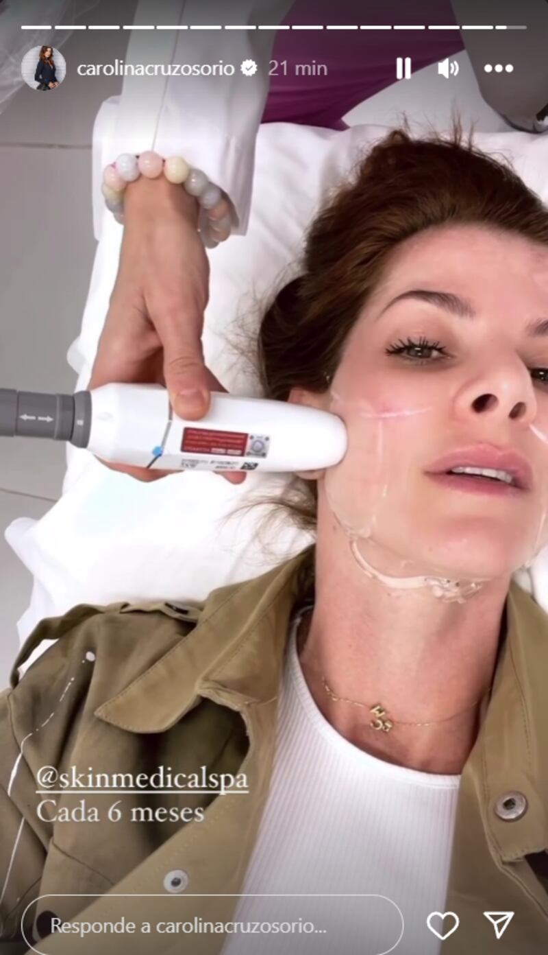 Carolina Cruz se sometió a procedimiento estético para lucir más jovén