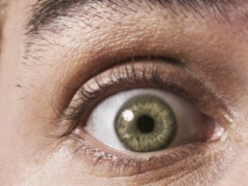 ¿Cómo tratar las bolsas de los párpados?