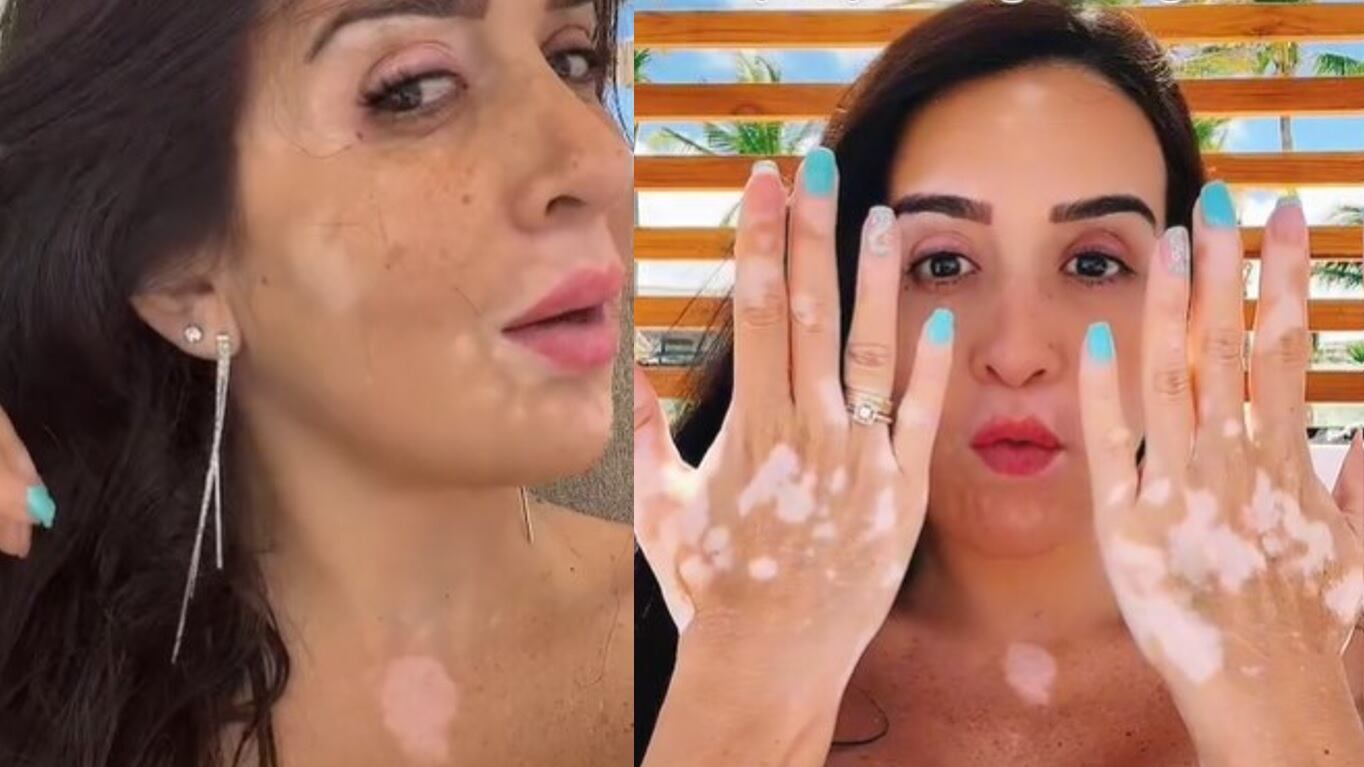 La creadora de contenido AdriLatina confesó que casi no se nota por los filtros que usa en las redes sociales y que tampoco maquilla las manchas.