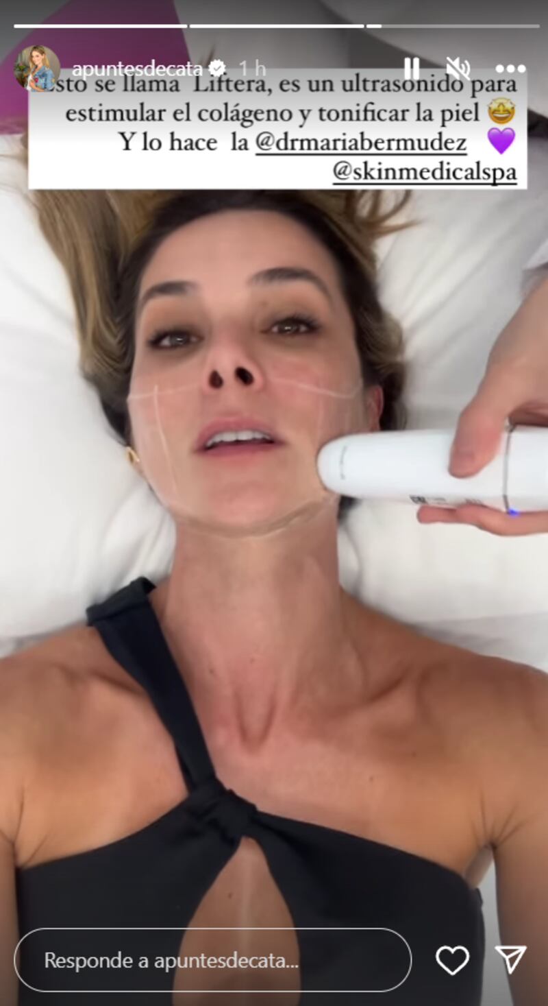 Catalina Gómez de 'Día a Día', se sometió a costoso tratamiento para mantenerse joven