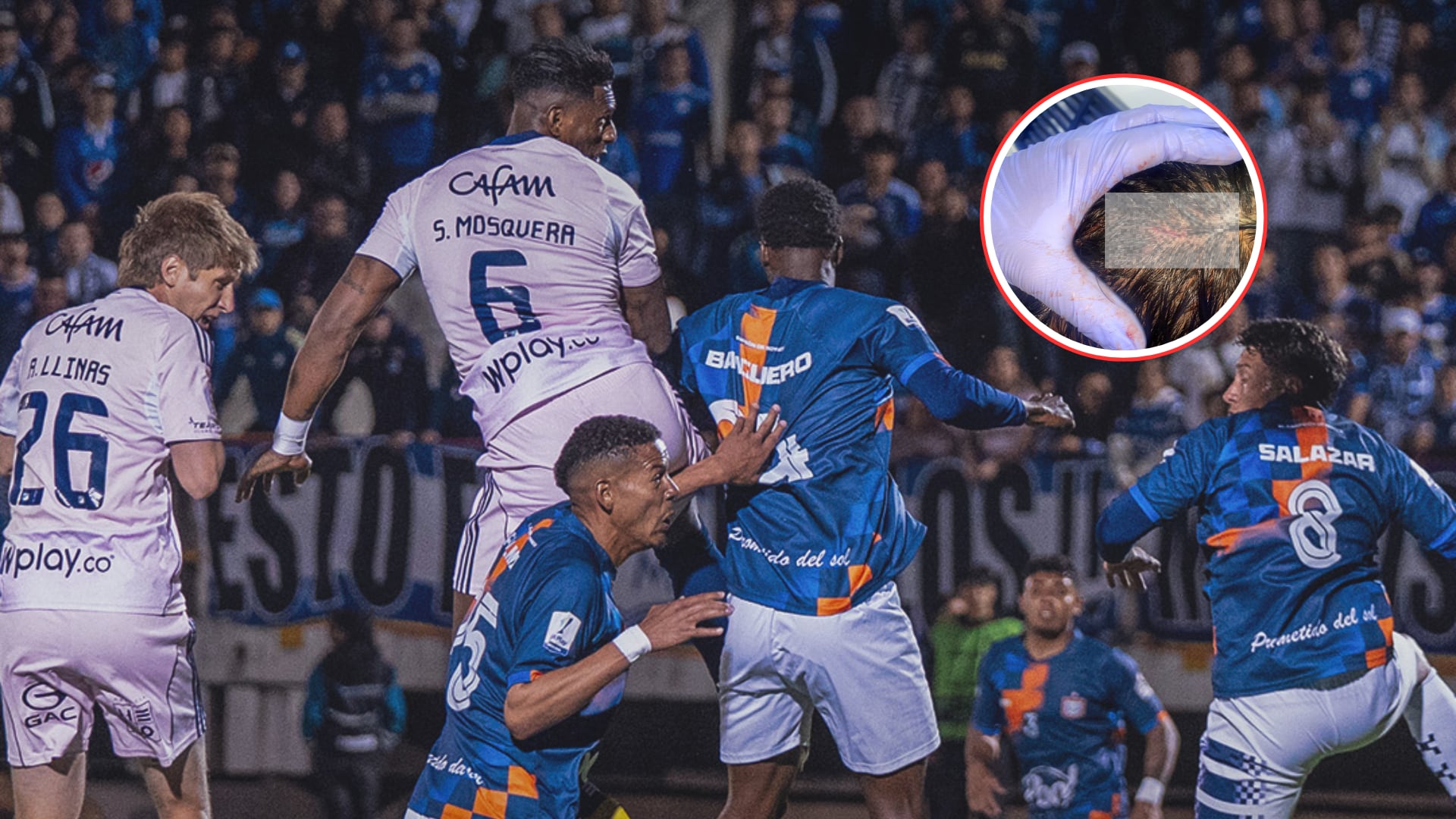 Nueva versión sobre el golpe de Jacobo Pimentel involucra a la Policía y ‘salva’ a los jugadores de Millonarios