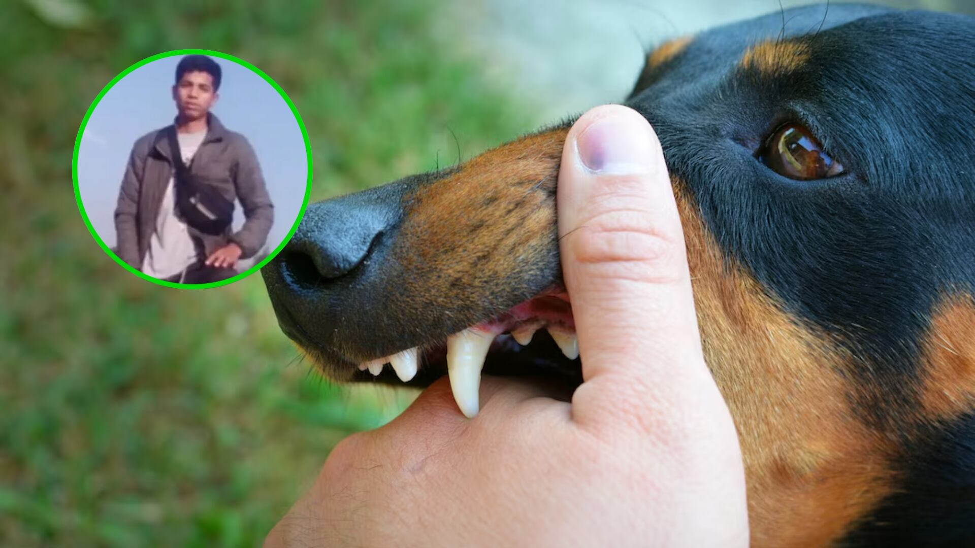 Identifican al joven de 19 años que sufrió más de 150 mordeduras por jauría de perros en Bogotá; permanece en UCI (Captura de pantalla de Noticias Caracol)