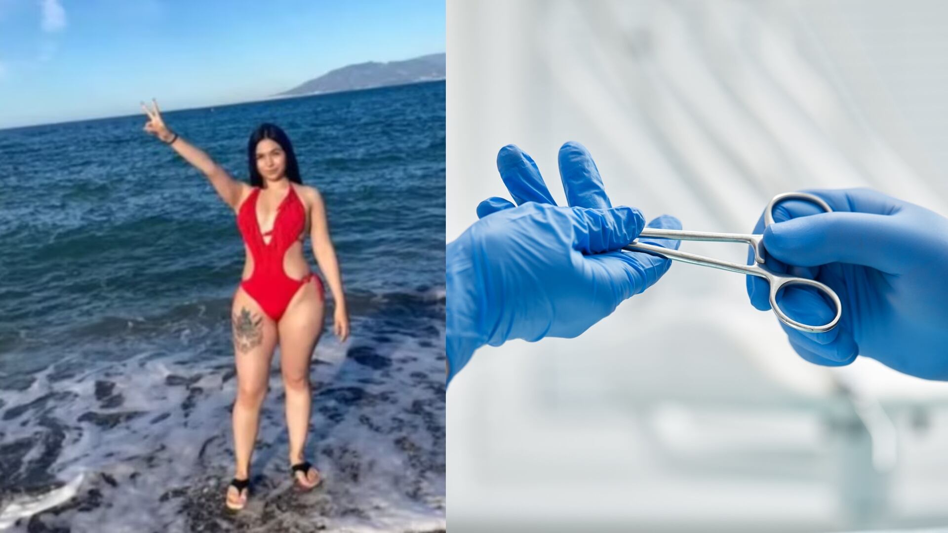 Joven de 23 años murió luego de que estilista le realizara una liposucción clandestina en Bogotá (Imagen de referencia y captura de pantalla de redes sociales)