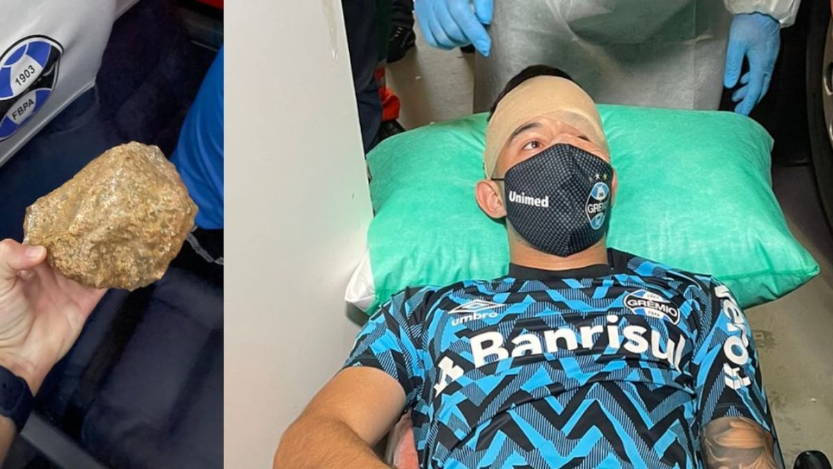 ¡Otro atentado en Brasil! Piedra impacta cabeza de jugador del Gremio