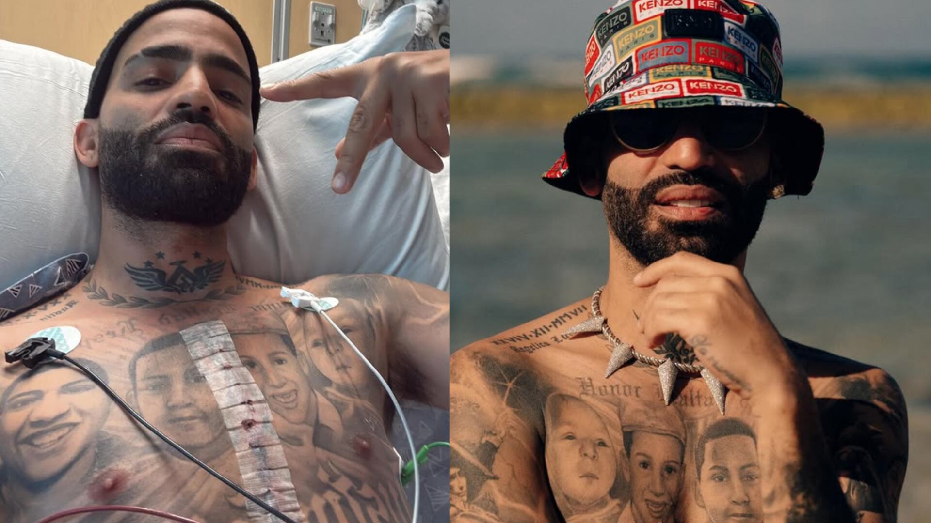 Árcangel fue sometido a delicada cirugía