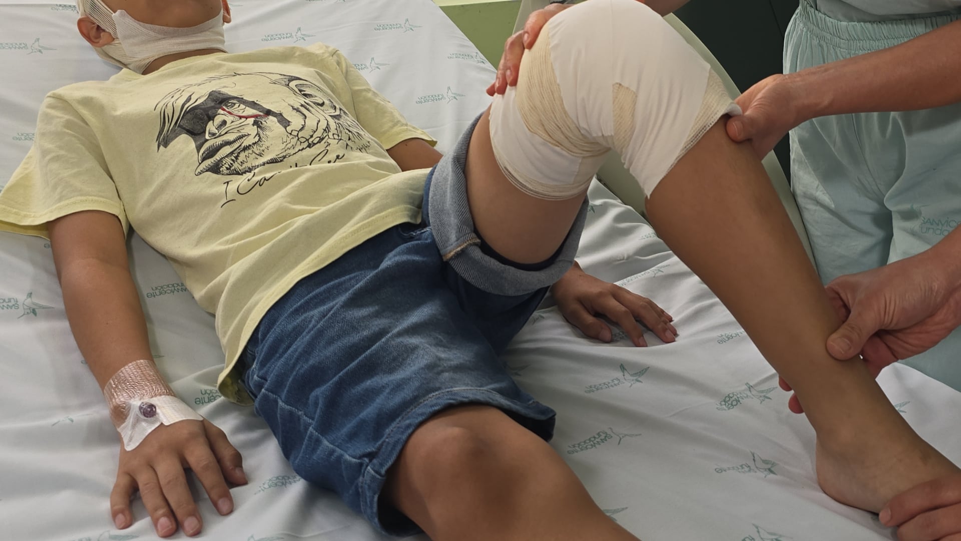 Quemados con pólvora