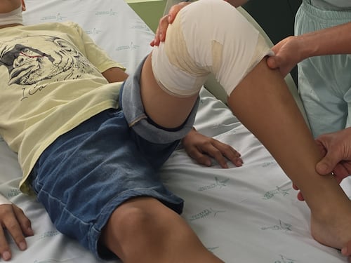 Alerta por quemados con pólvora y líquidos calientes durante la Navidad en Medellín