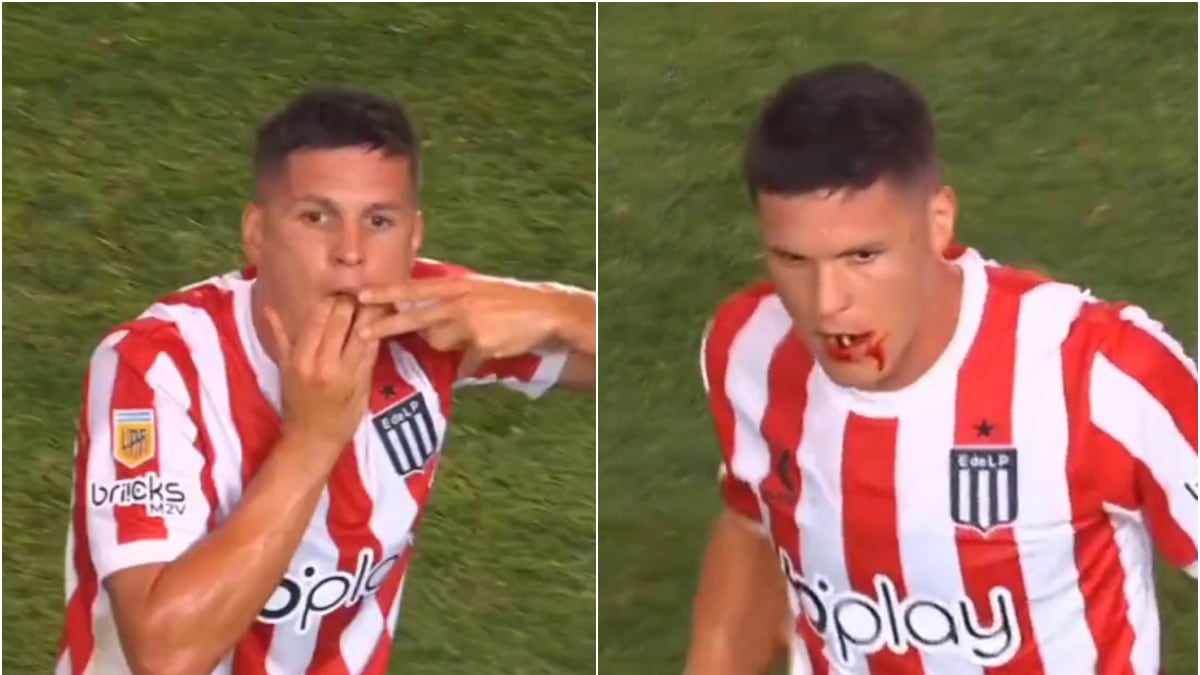 A un jugador le sacaron a volar los dientes de un codazo y el VAR ni se mosqueó