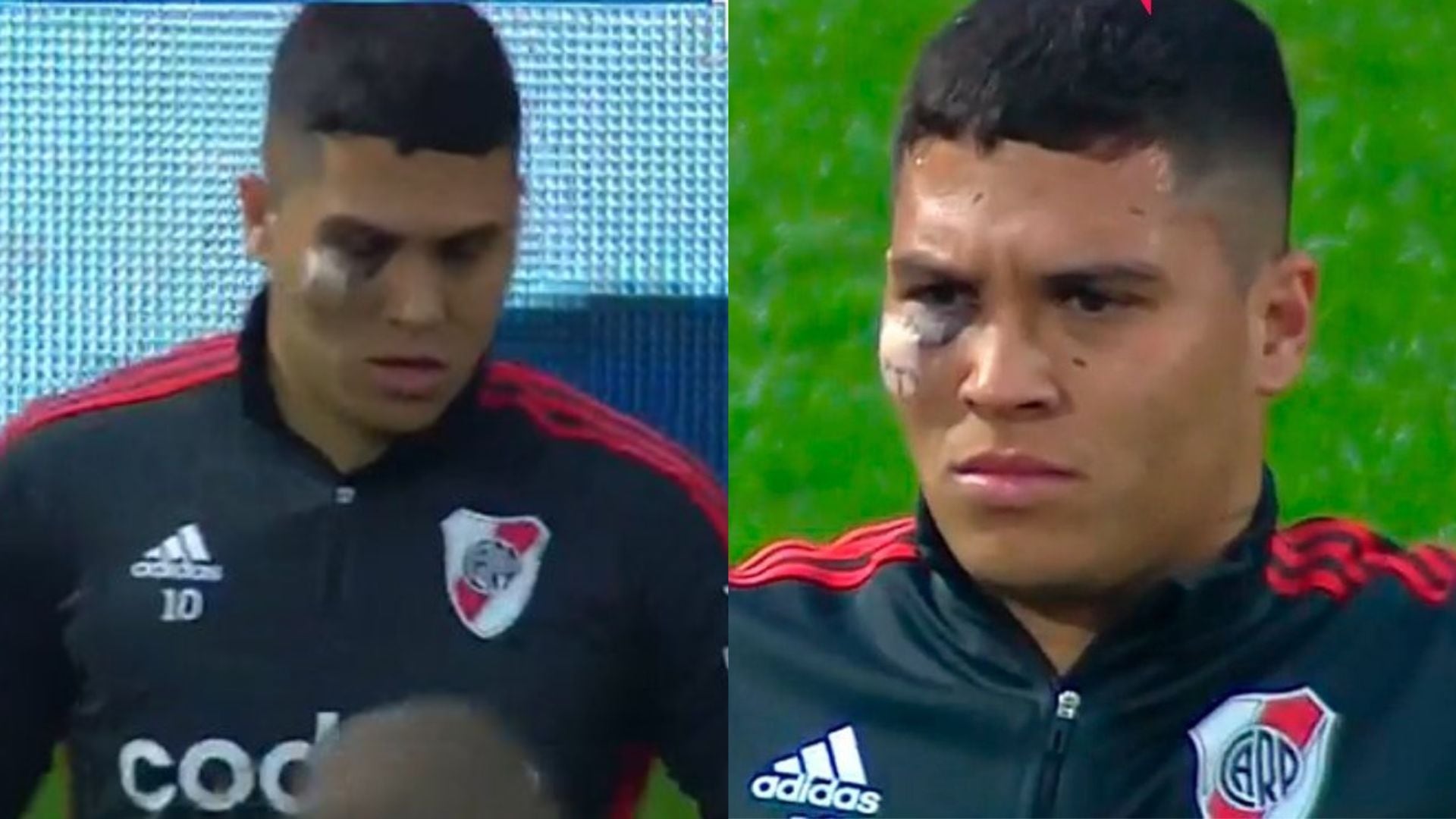 'Juanfer' Quintero recibió un fuerte golpe con River Plate.