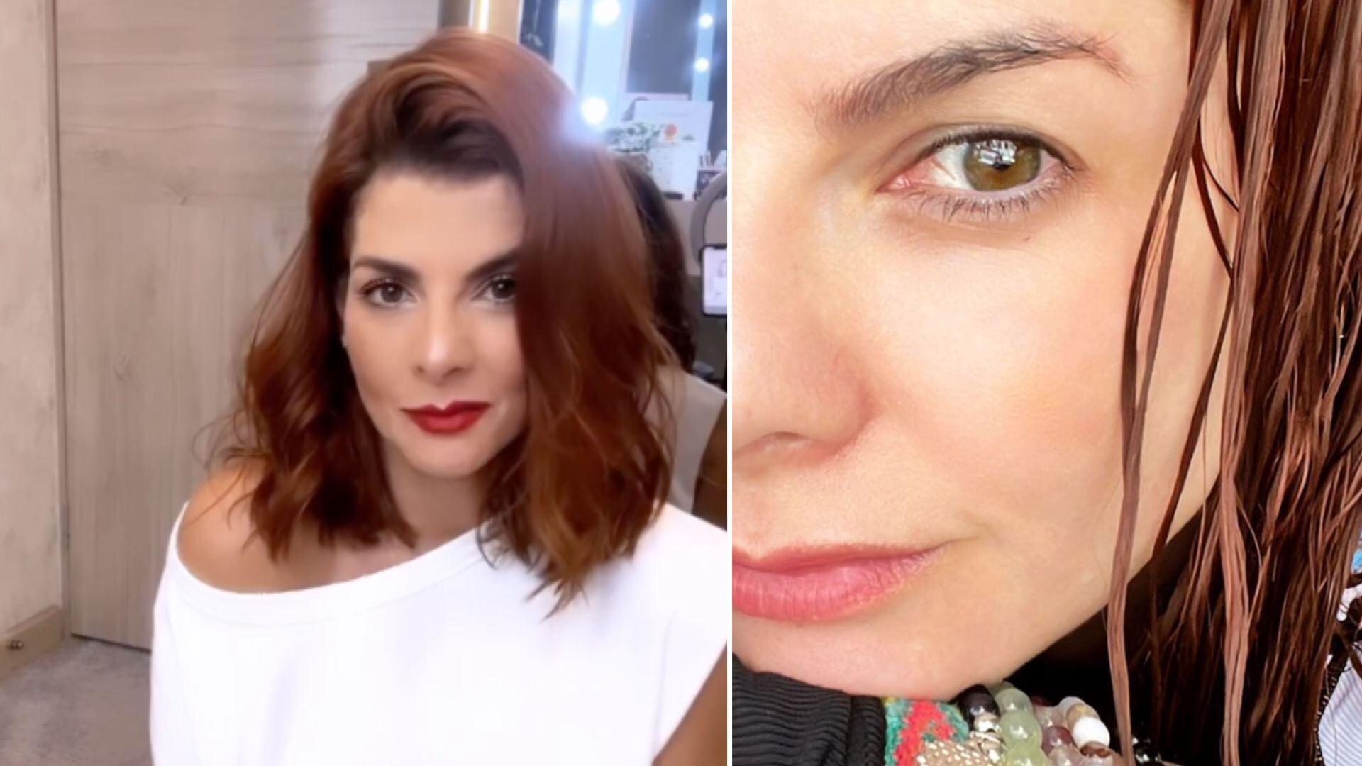 habla de sus problemas en la piel