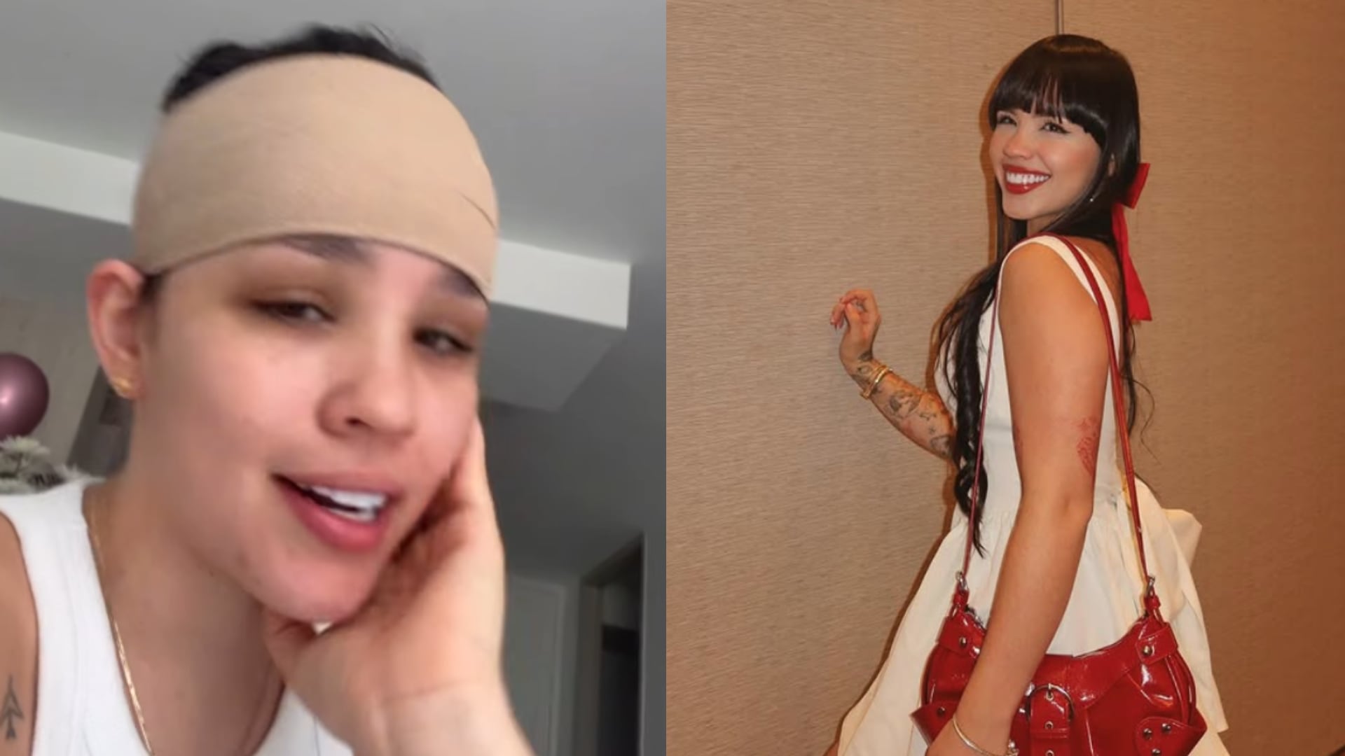 Fer realpe y su operación