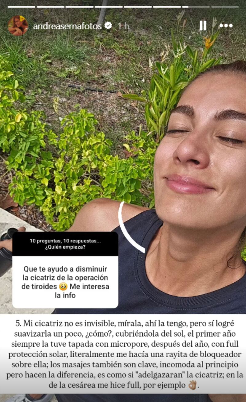 Andrea Serna habló de los tratamientos a los que se sometió tras delicada cirugía por la que pasó