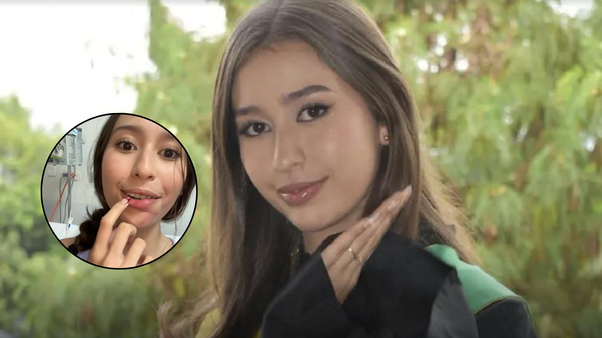 Ana Isabel Pulgarín, sobreviviente del accidente de bus en Antioquia