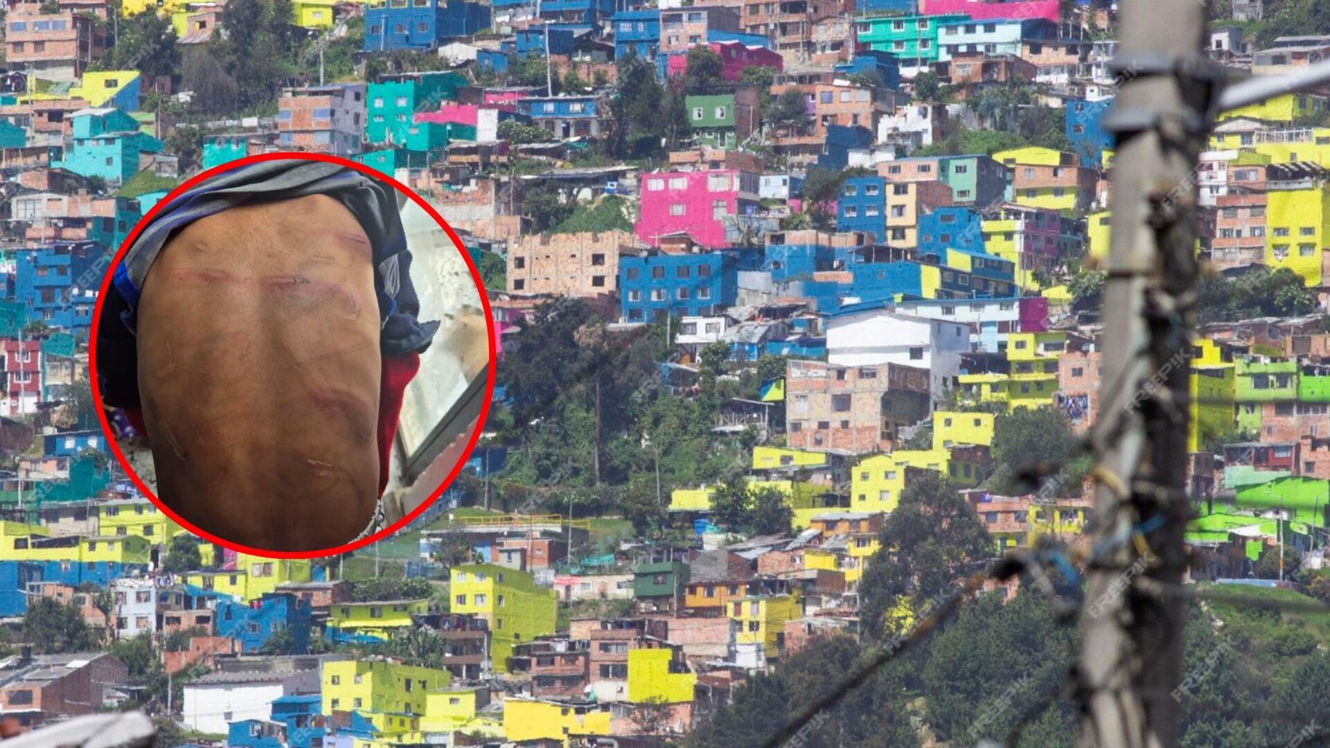 Agresión niños Soacha