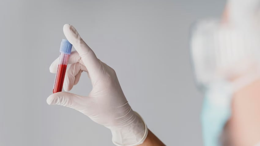 Prueba de sangre para detectar el alzhéimer