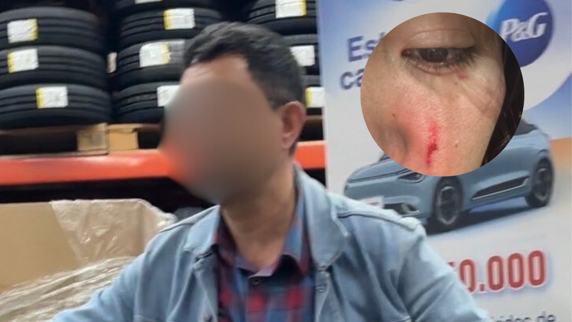 Mujer denuncia grave agresión en famoso almacen de cadena.