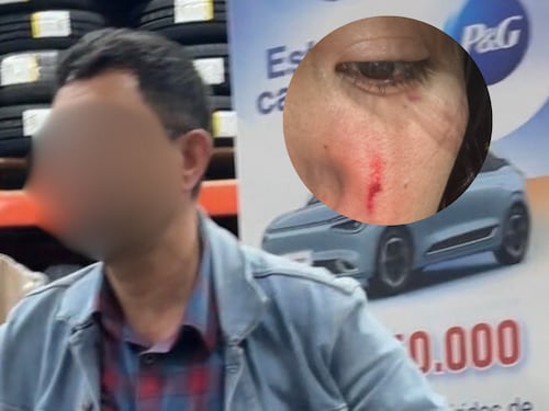Mujer denuncia grave caso de agresión en reconocida cadena de almacenes en Bogotá: “me cuesta caminar del dolor”