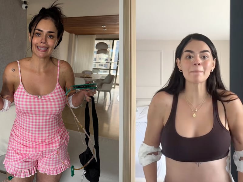 La Segura mostró la impresionante cicatriz que le quedó tras las cirugías estéticas a las que se sometió