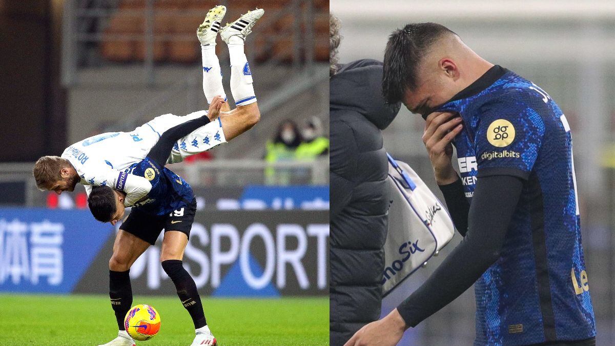 Extravagante jugada dejaría a Argentina con su primera baja ante Colombia