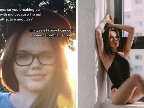 Su novio termina con ella por no ser guapa, ahora es una supermodelo