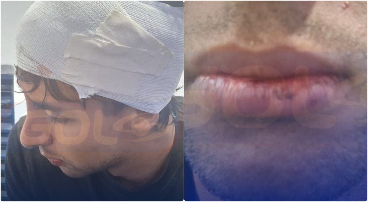 “No habría sancionados”, equipo arbitral a periodista, tras pelea entre Chicó y Millonarios 