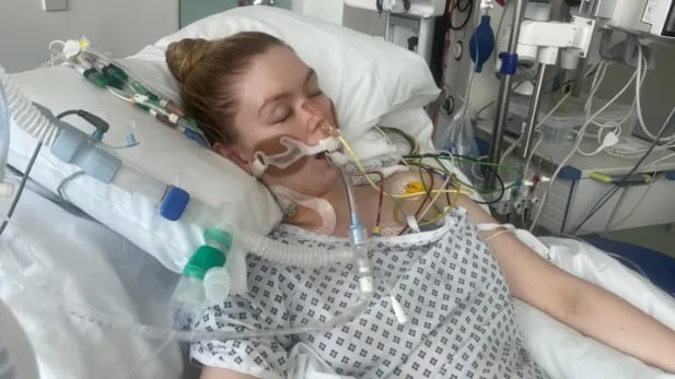 “Pensé que era gripe”: mujer joven casi muere por sepsis tras dolor de garganta