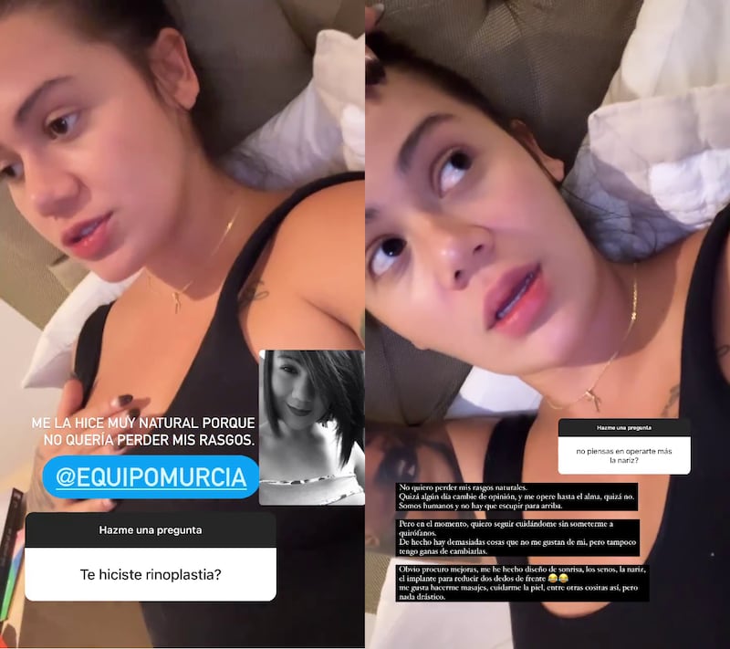 Cintia Cossio habló sobre las cirugías que se ha hecho