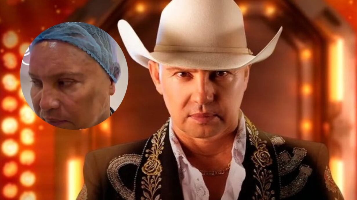 Giovanny Ayala se sometió a procedimiento estético para verse más joven y así quedó