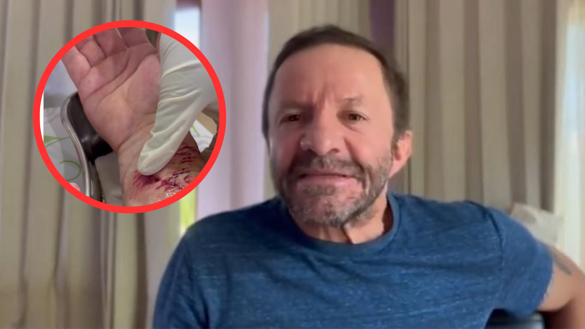 'Pirry' reveló sus cicatrices