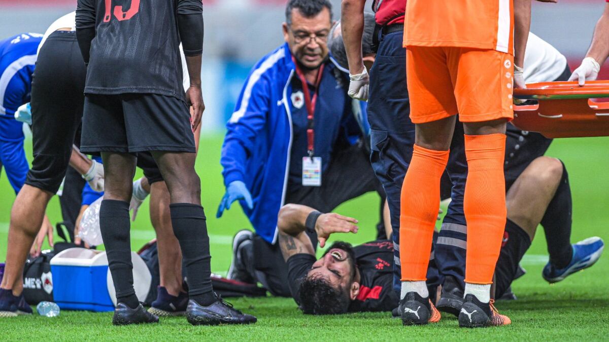 Yaser Hamed, compañero de James Rodríguez, sufrió impactante lesión