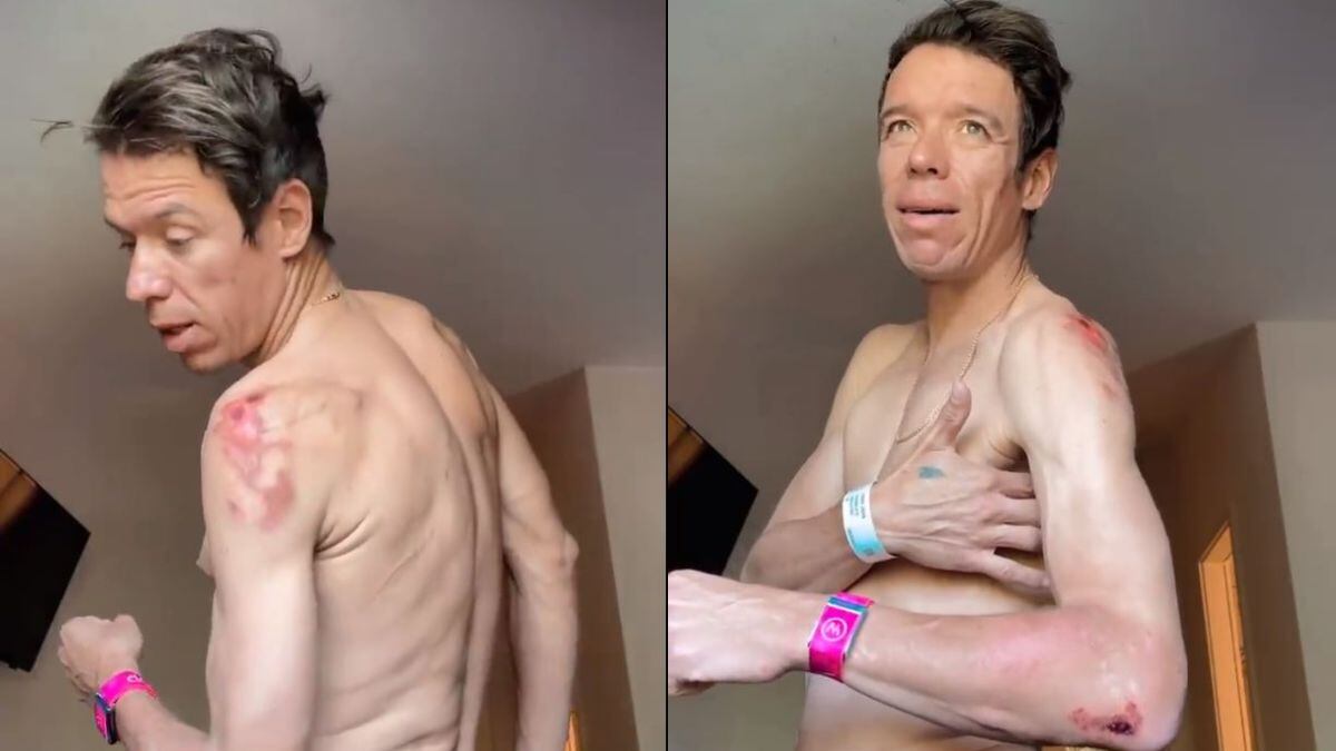 Rigo Urán confirma sus temores: está fracturado tras su caída en Romandía